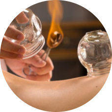 cupping2