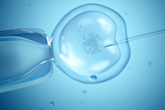 ivf 2