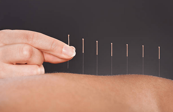 needles in a row-min