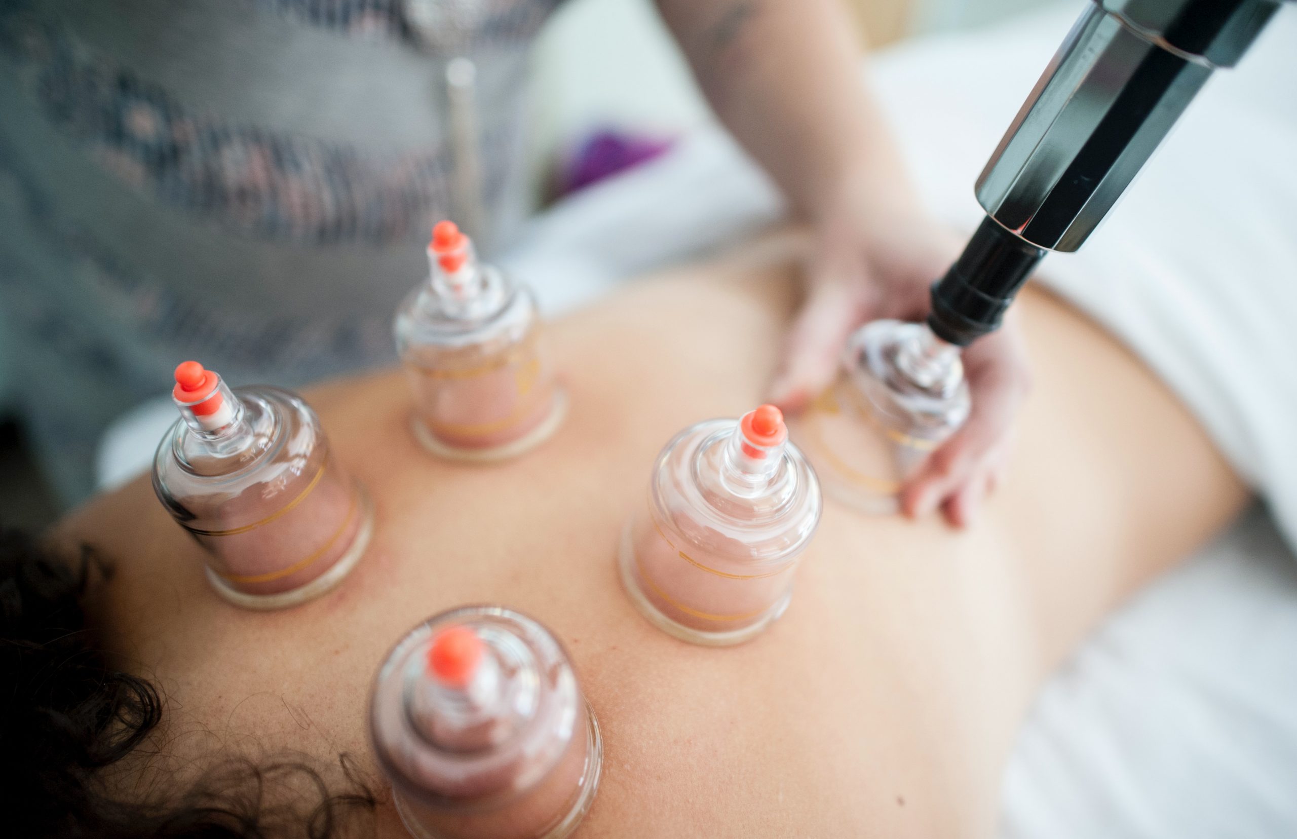 What Happens Within An Acupuncture Facial?